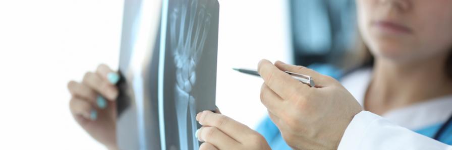 Handgelenkbruch ist auf einem Röntgenbild gut sichtbar