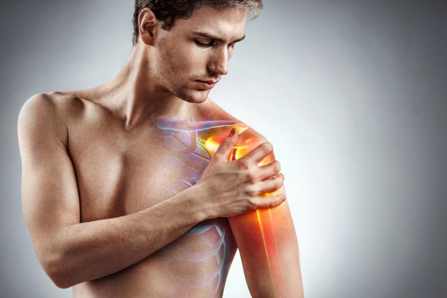 Wenn die Schultern schmerzen kann es sich um eine Schultereckgelenksprengung handeln