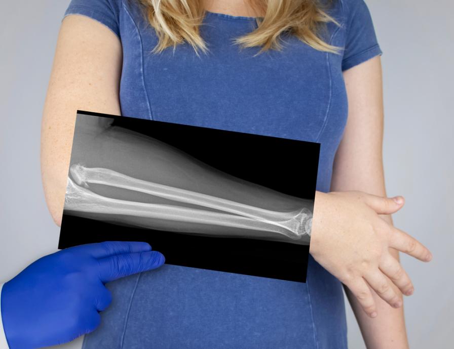 Ein Bild der Knochenstruktur des Unterarms