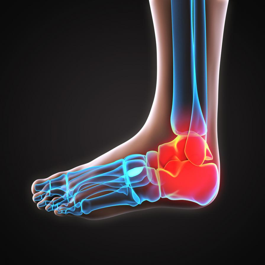 Darstellung der Fußknochen