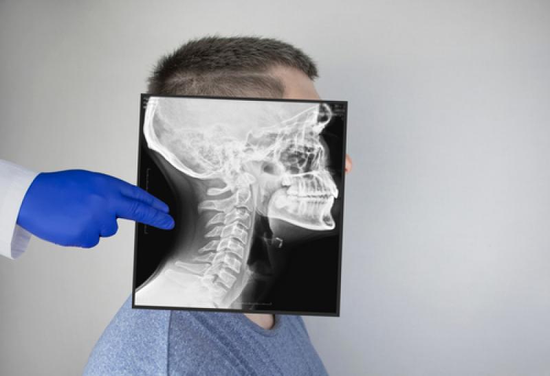 Ein Röntgenbild hilft bei der Diagnose